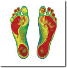 Foot Scan Orthotics Chicago