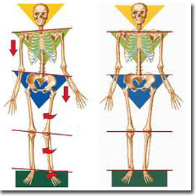Chicago Orthotics