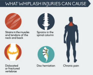 Whiplash Injuries