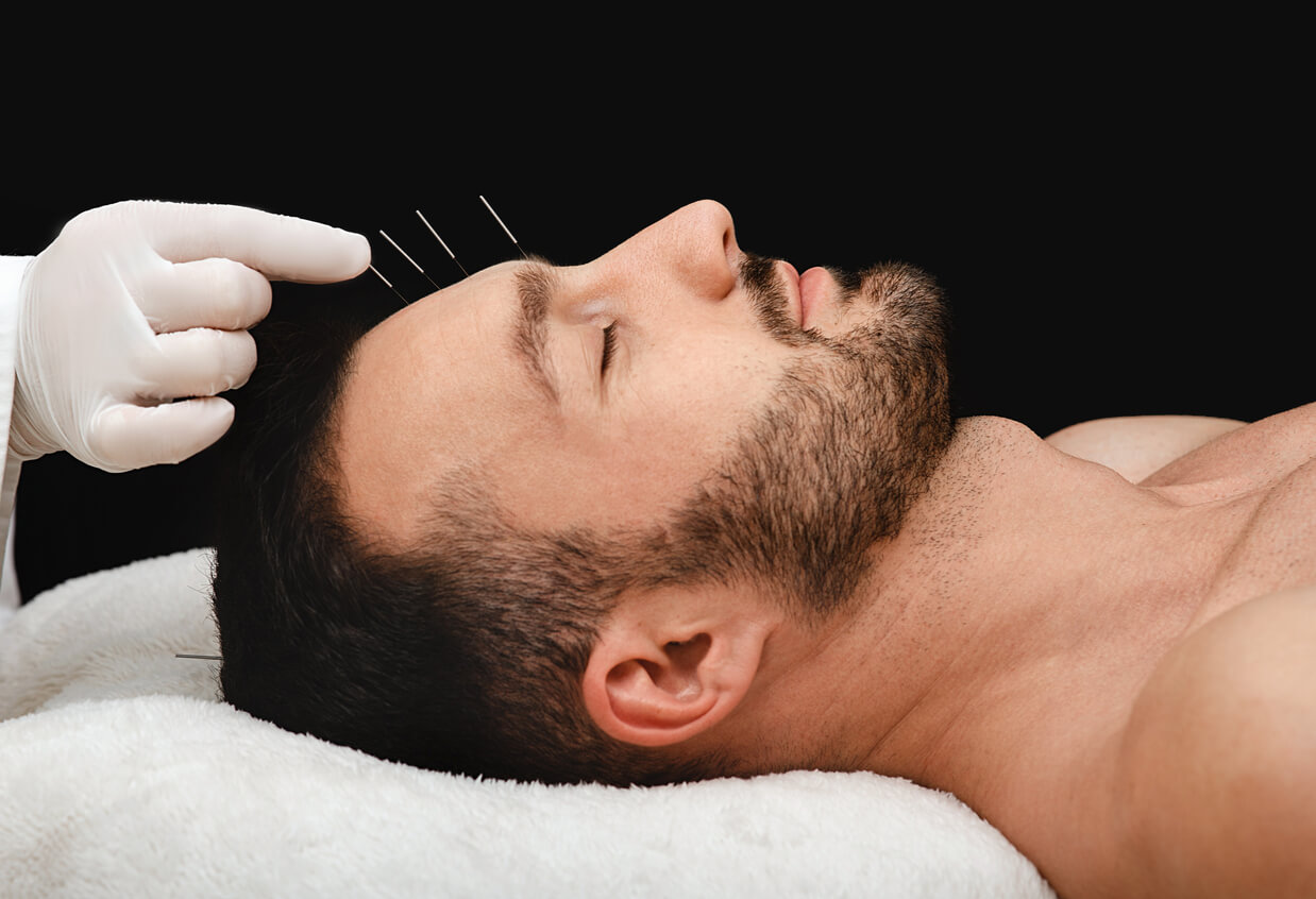 Man having acupuncture treatment on his face